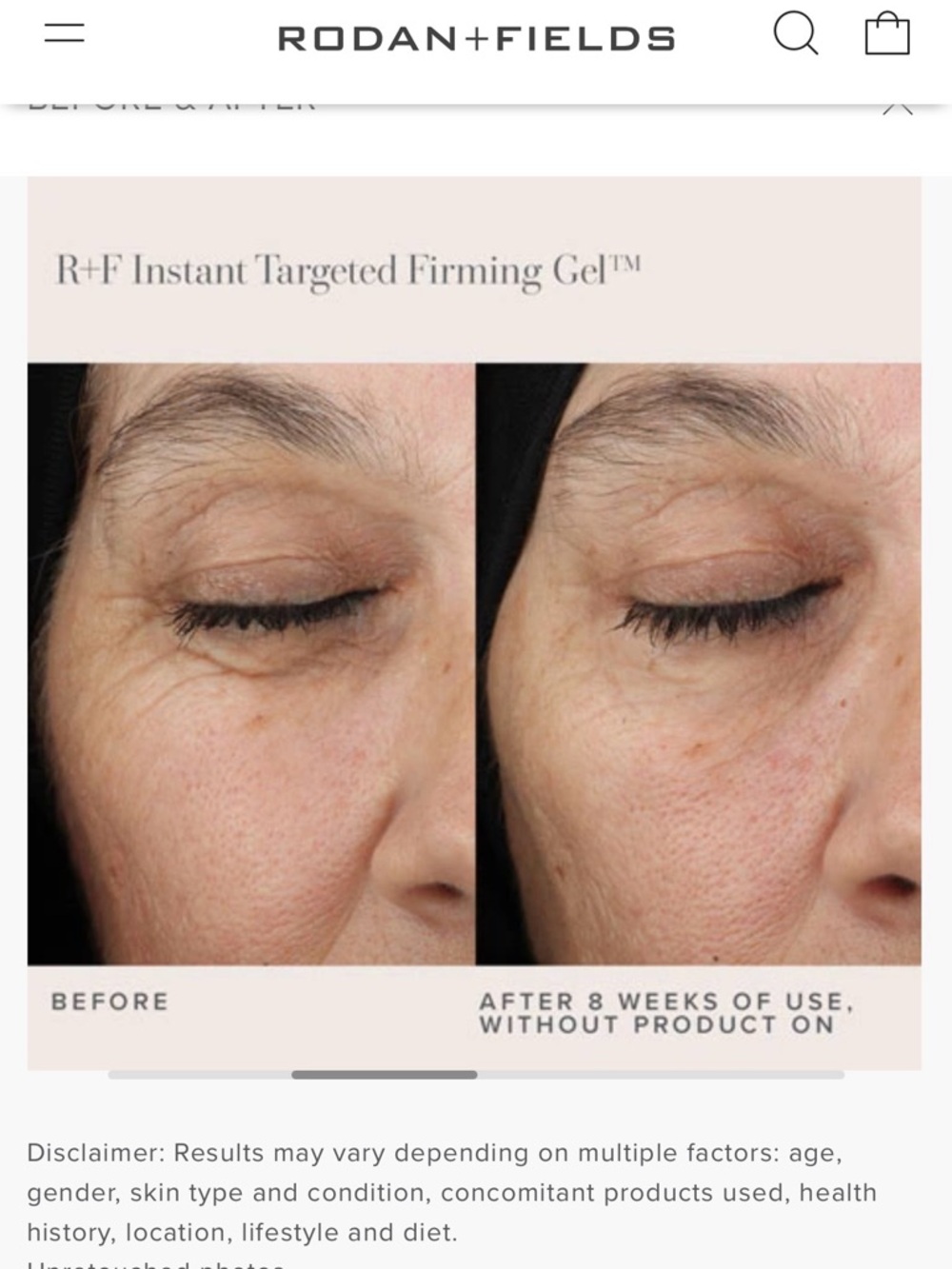 NWT Rodan + Fields R+F Instant Targeted Firming Gel 10 mL - Picture 10 of 17
